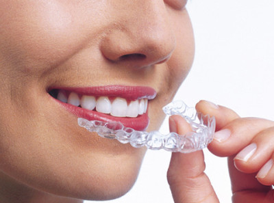 Can you kiss someone with invisalign?