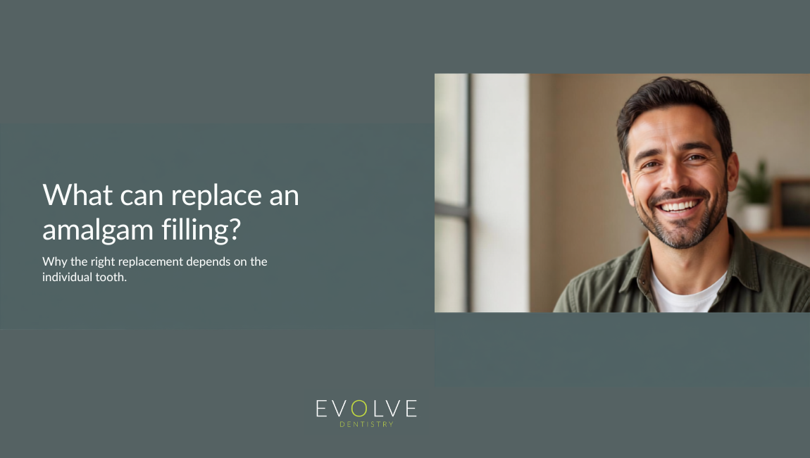 What can replace an amalgam filling?